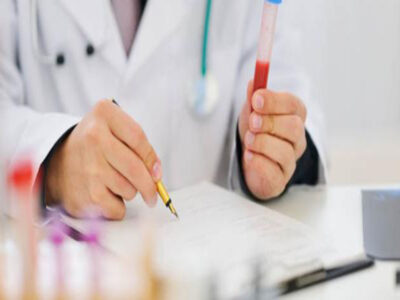 تحليل وفحوصات الهرمونات بمعامل الدكتور محمد خضر بكفر الشيخ